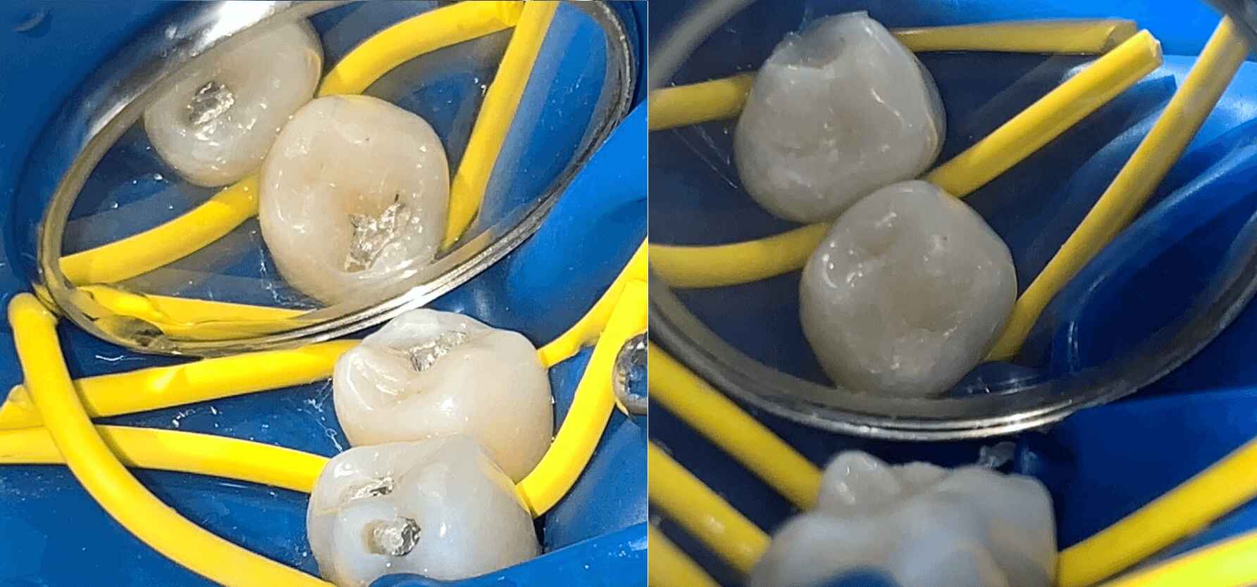 tratamiento1 clinica odontologica altata