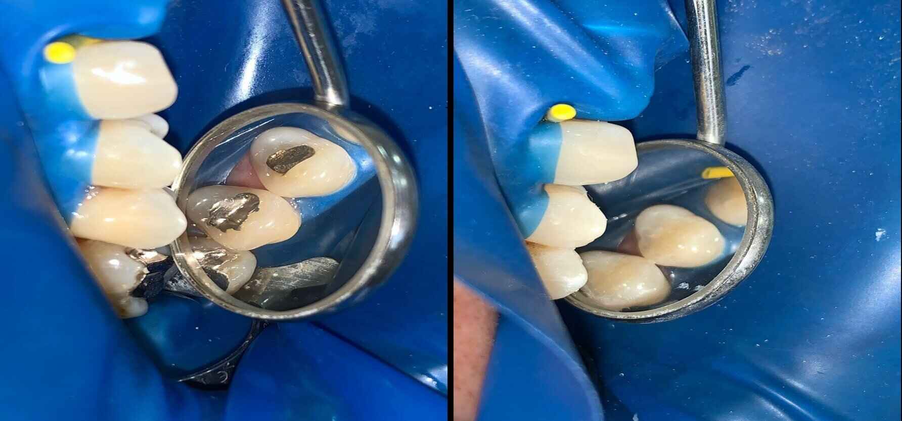 tratamiento10 clinica odontologica altata