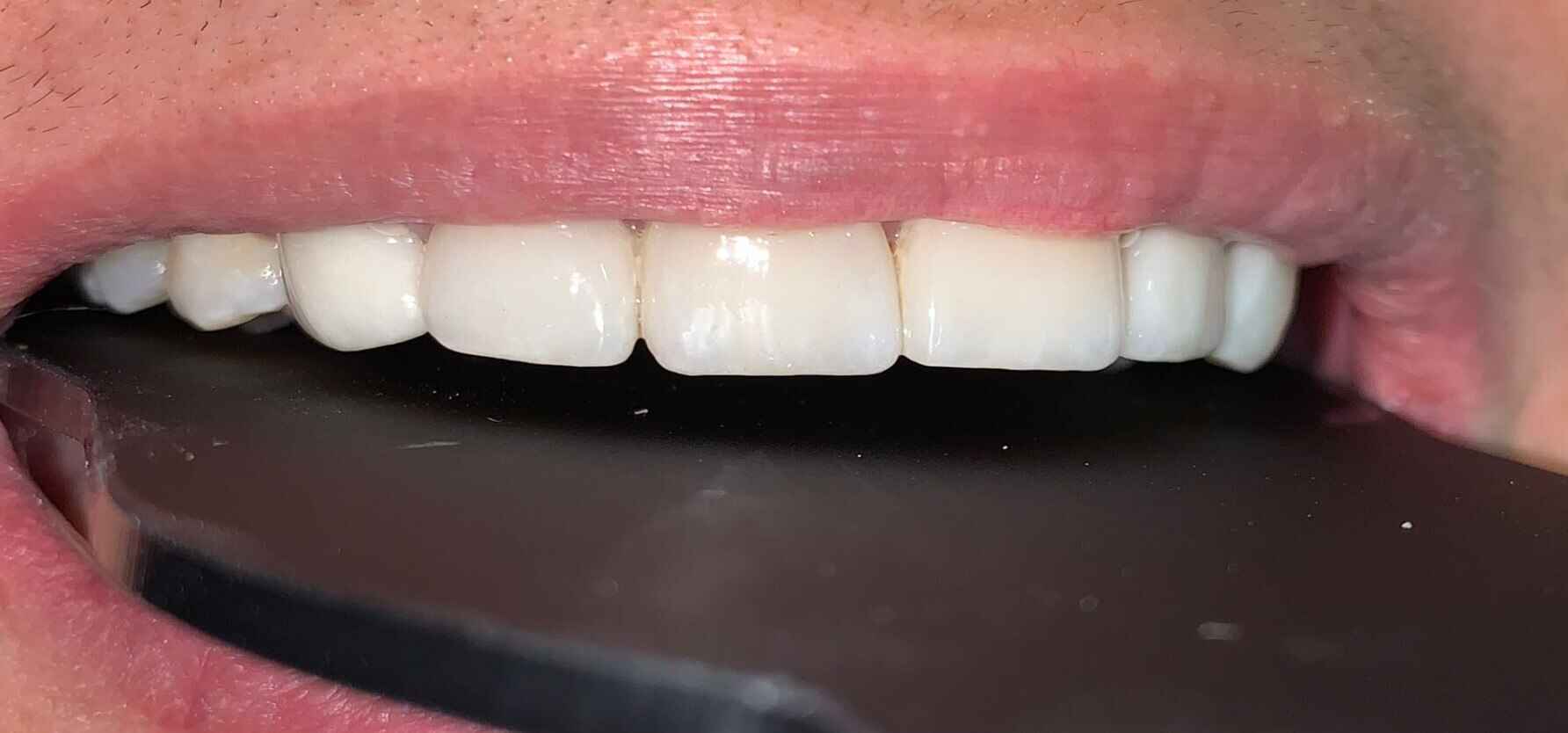 tratamiento6 clinica odontologica altata