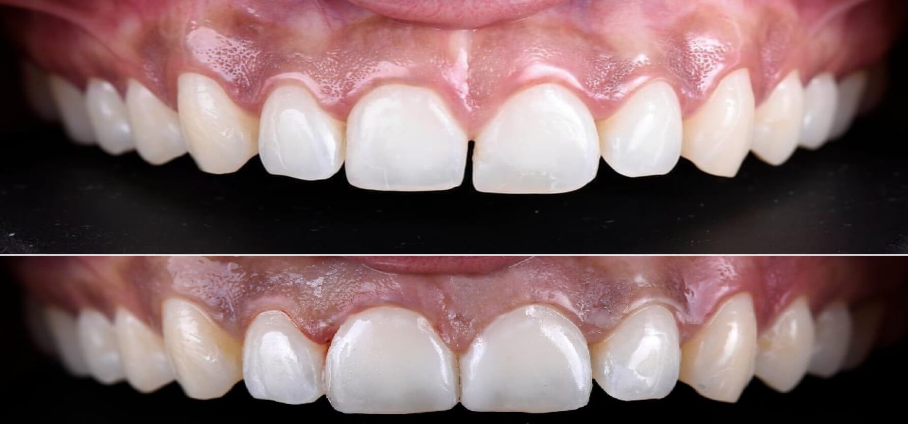 tratamiento22 clinica odontologica altata